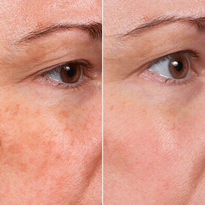 Harlwick™ Rejuvenate Face Serum